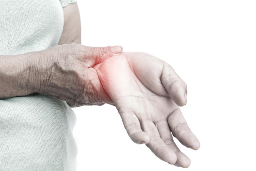Rheumatoid Arthritis